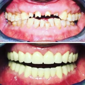 prima e dopo loperazione ai denti a belgrado